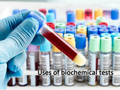 Biochemistry